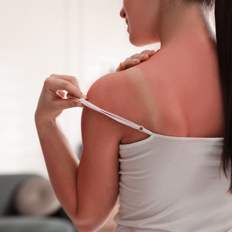 The Potential Effects of Not Wearing Sunscreen